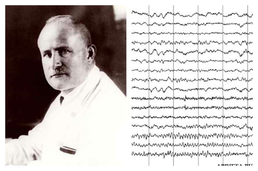 Hans Berger