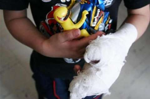 A la cárcel madre que habría quemado las manos de su hijo de 9 años con ayuda de la abuela