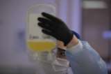 Suspenden ensayos con plasma de convalecencia para pacientes con COVID-19 por no mostrar beneficios