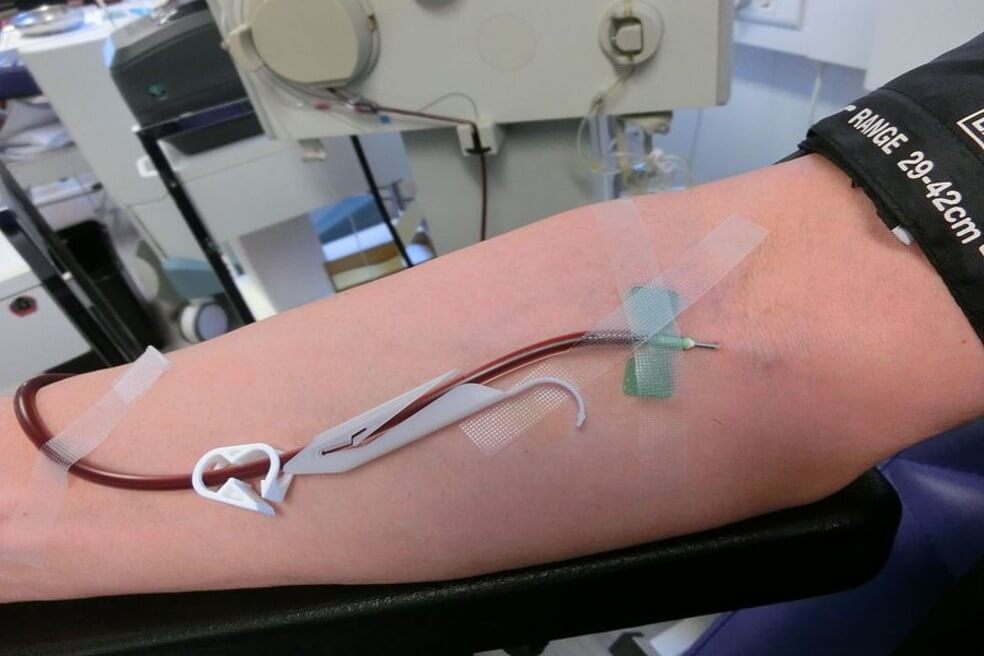 El plasma es, en palabras sencillas, la parte líquida de la sangre que concentra los anticuerpos tras una enfermedad. / Wikimedia Commons