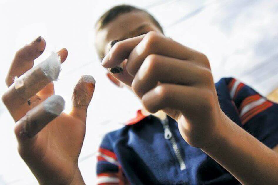 El 16% de los afectados en el departamento son niños que se encuentran en su mayoría observando cómo los adultos lanzan los fuegos artificiales.