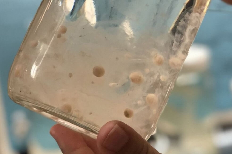 Medición de microplásticos en salpas. / Scripps Institution of Oceanography - Europa Press