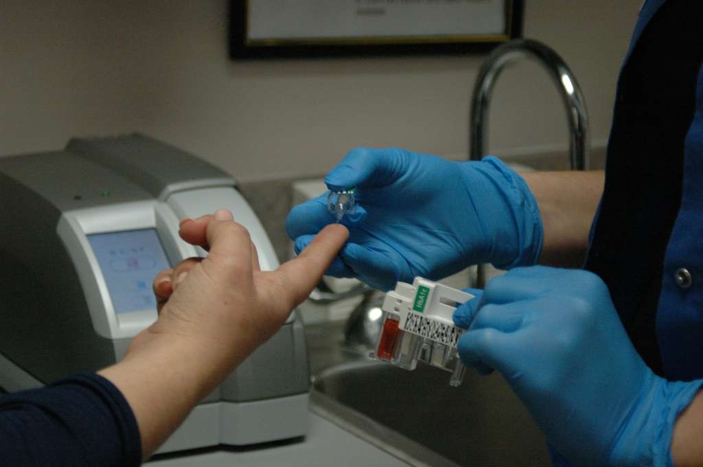 Diabetes tipos de diabetes y covid 19