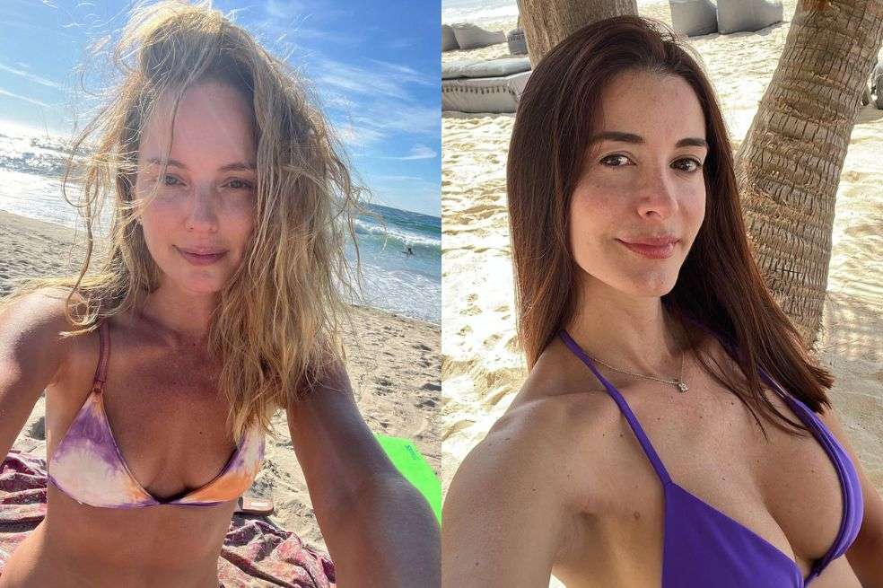 Estas celebridades decidieron, después de años, regresar a la naturalidad y explantar sus prótesis.