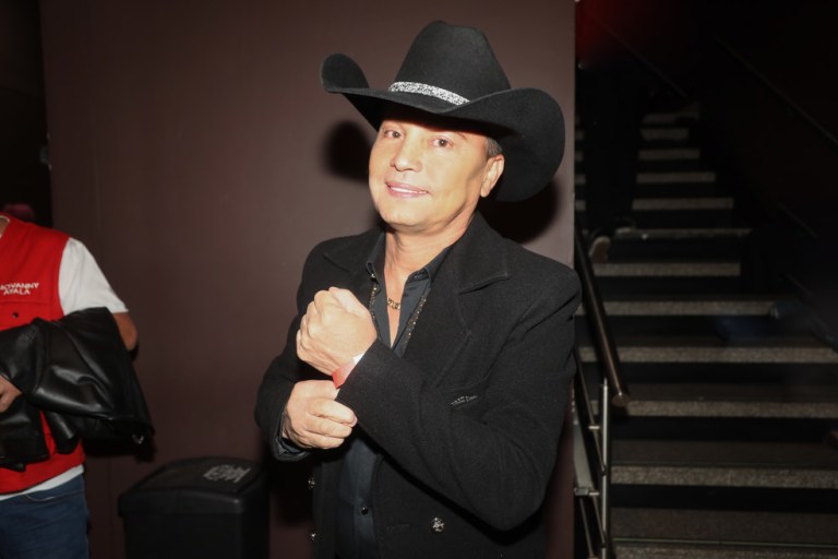 Giovanny Ayala antes y después: impactó con “tremendo cambio” en su cara
