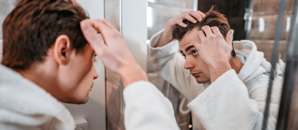 Implantes capilares: una opción popular para tratar la pérdida de cabello