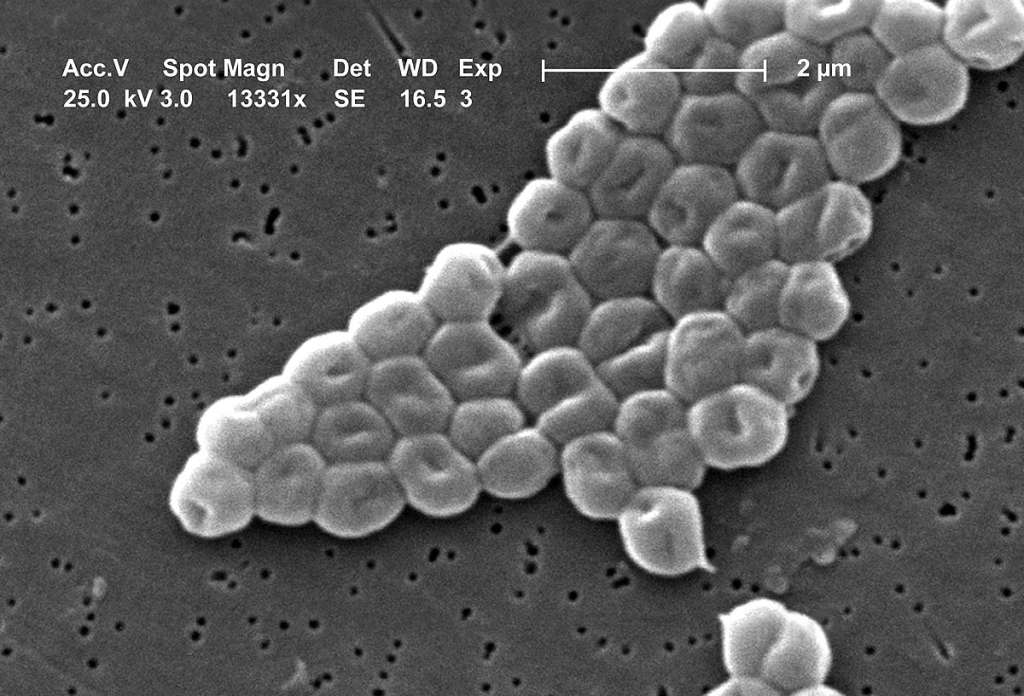 Imagen de referencia. Bacteria del género Acinetobacter, al que pertenece la bacteria modificada en el estudio.