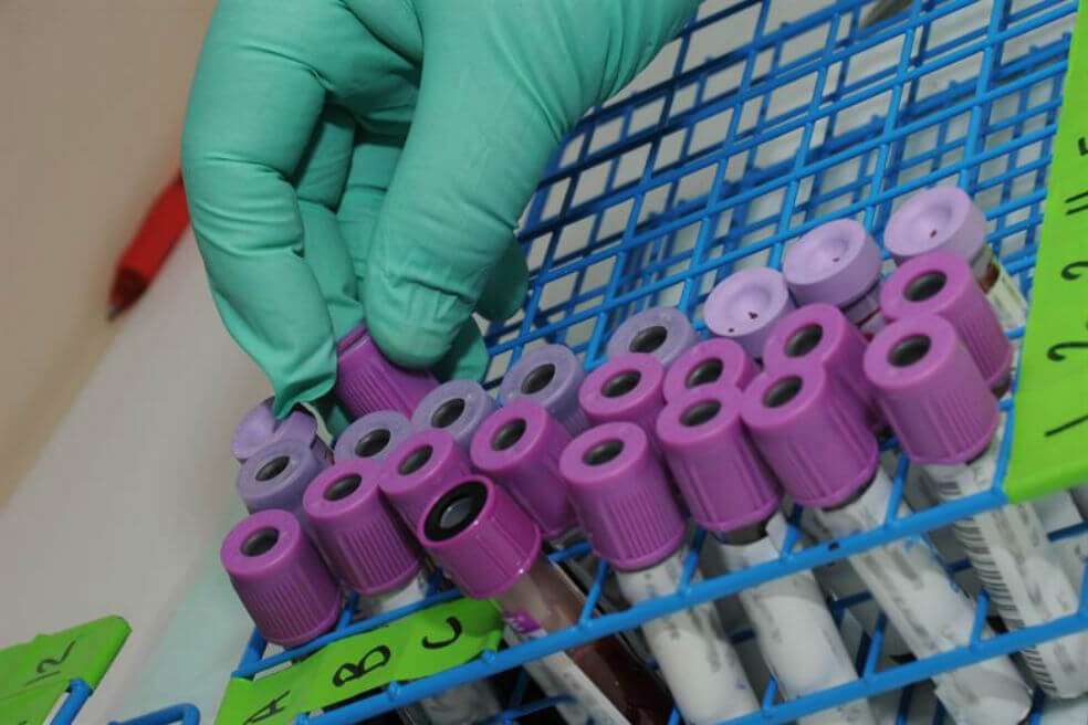 Para llegar a sus conclusiones, los autores analizaron la secuenciación de genomas del virus aislados de más de cien pacientes de todo el mundo, disponibles en bases de datos genómicos, y los compararon con virus en animales. / Kessler Lab