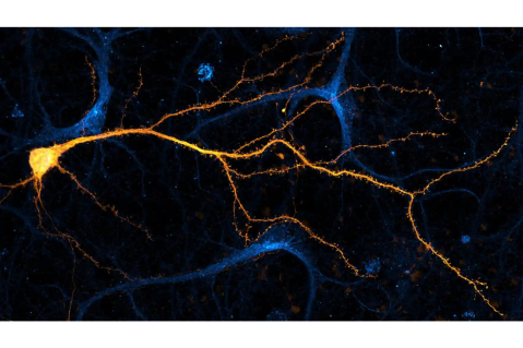 Las neuronas podrían tener un origen que nadie se había imaginado: el mar