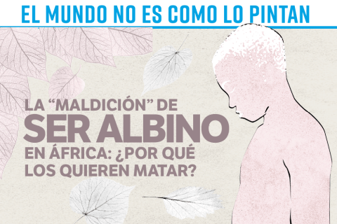 La “maldición” de ser albino en África: ¿por qué los quieren matar?