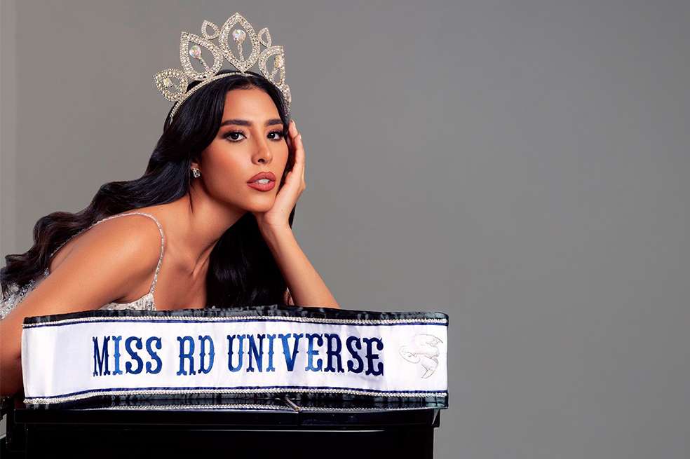 Ex Miss Universe sufre graves quemaduras al explotar olla a presión
