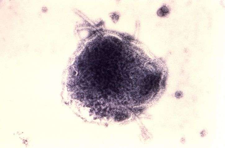El sarampión es causado por un virus de la familia de los paramixovirus y normalmente se suele transmitir a través del contacto directo y del aire.