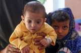 En fotos: los niños muestran el riesgo de hambruna que vive Yemen