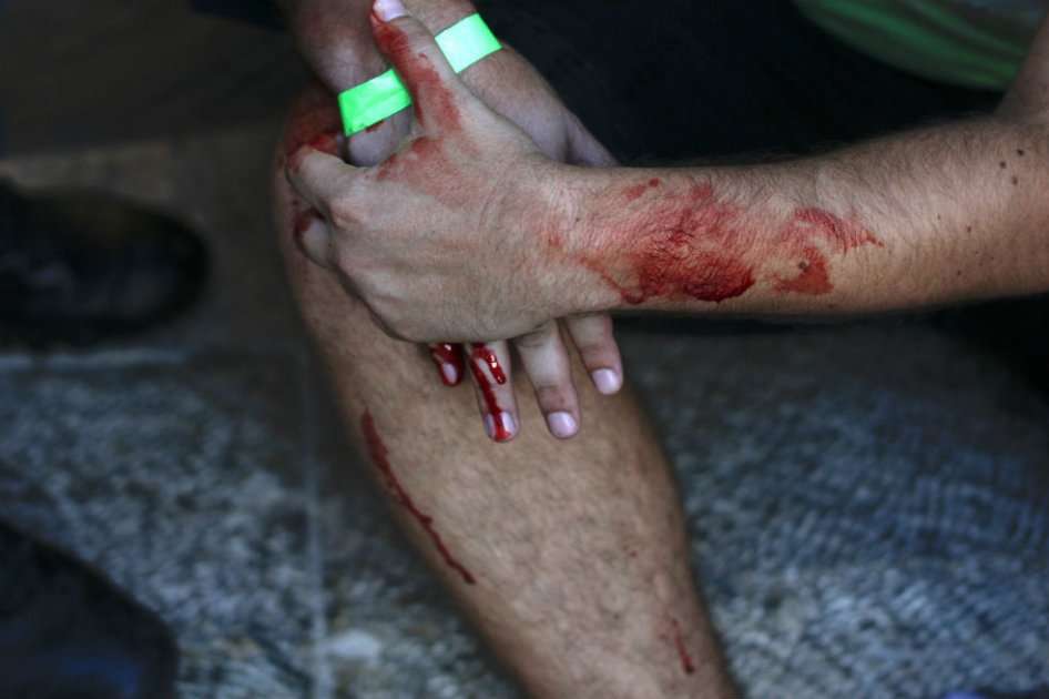 Un herido recibe atención médica tras el ataque durante la Marcha del Orgullo Gay en Jerusalén, Israel / EFE