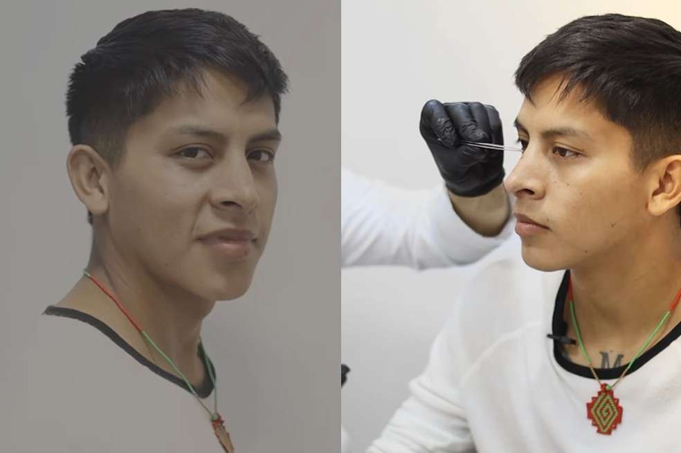 “Increíble”, comentaron en redes sociales al ver el resultado final de una cirugía estética a la que se sometió hace un mes el finalista del ‘Desafío The Box 2023′.