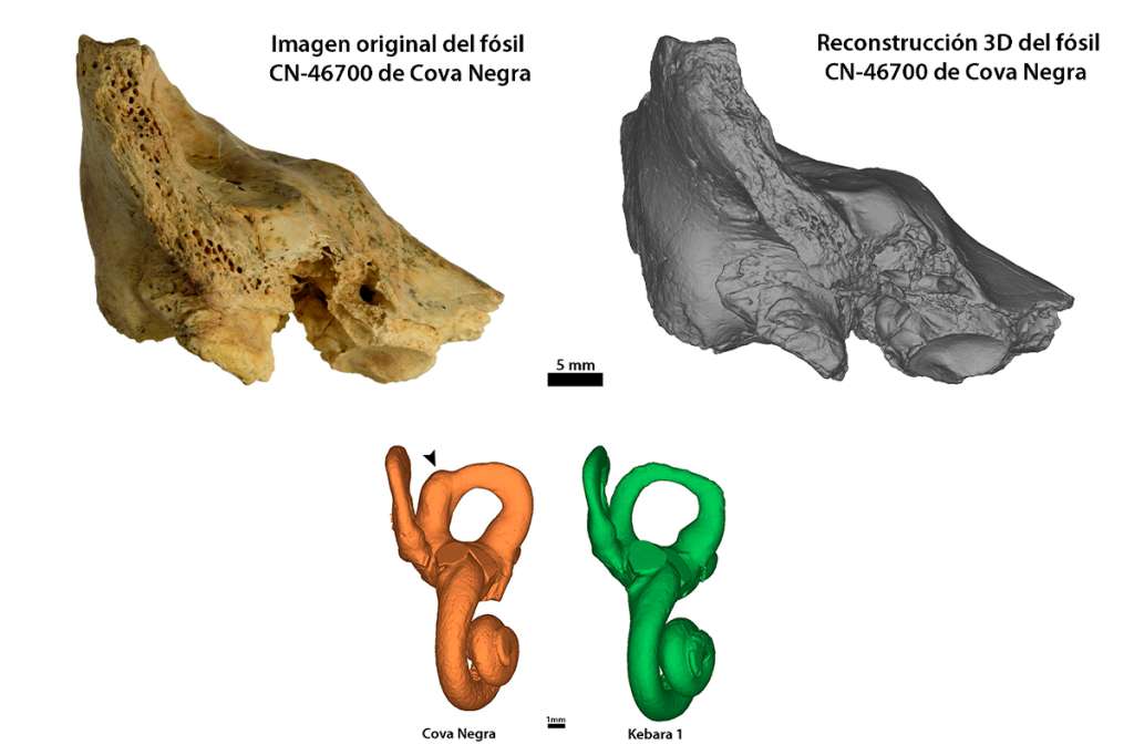 Arriba: Hueso temporal original y reconstrucción 3D del fósil CN-46700 de Cova Negra en vista anterior.
Abajo: Modelos 3D del oído interno de Cova Negra mostrando la dilatación patológica del canal semicircular anterior comparado con Kebara 1, un neandertal que no presenta la patología.