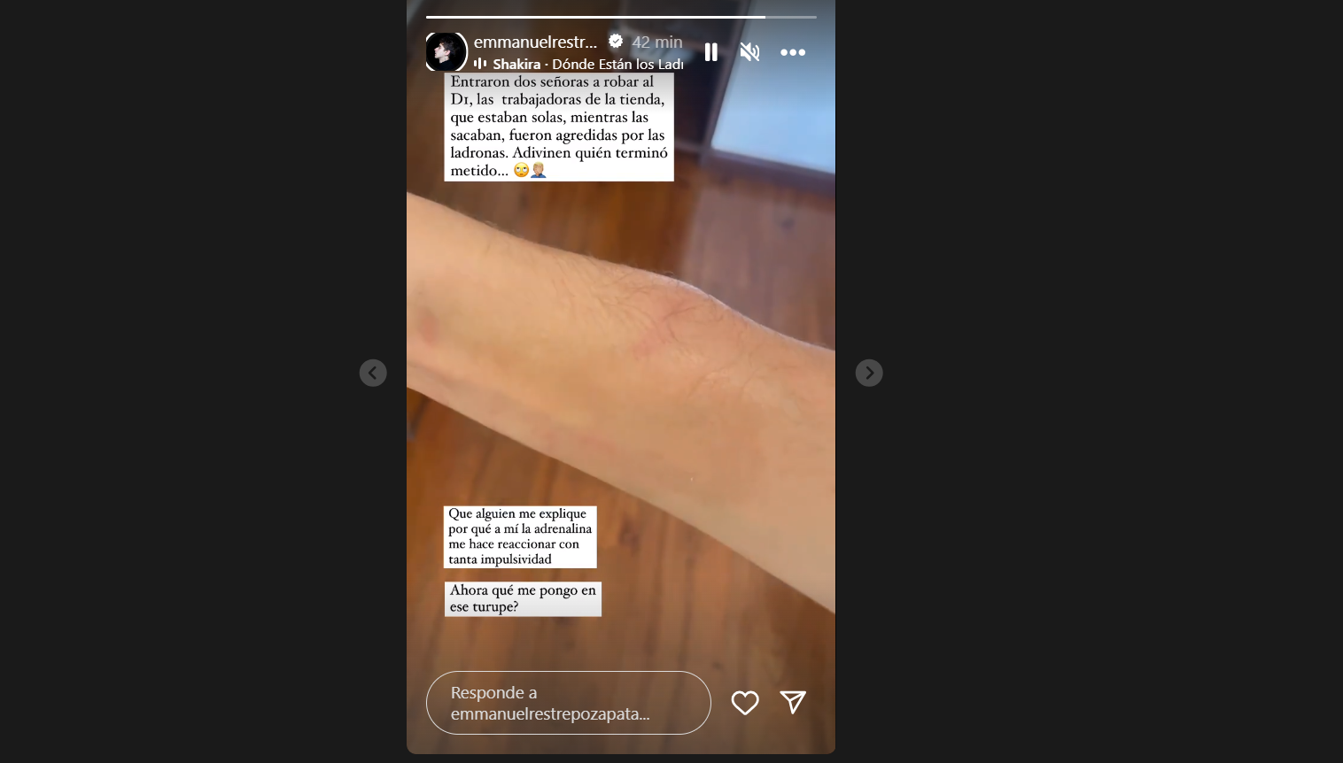 Emmanuel Restrepo, de ‘Rigo’, resultó lesionado en medio de un robo