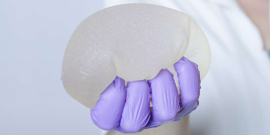 ¿Existe una relación entre los implantes mamarios y el cáncer?