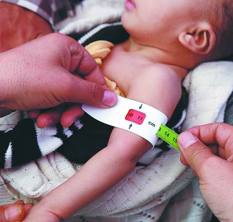 Desnutrición en menores, un asunto muy preocupante en Antioquia
