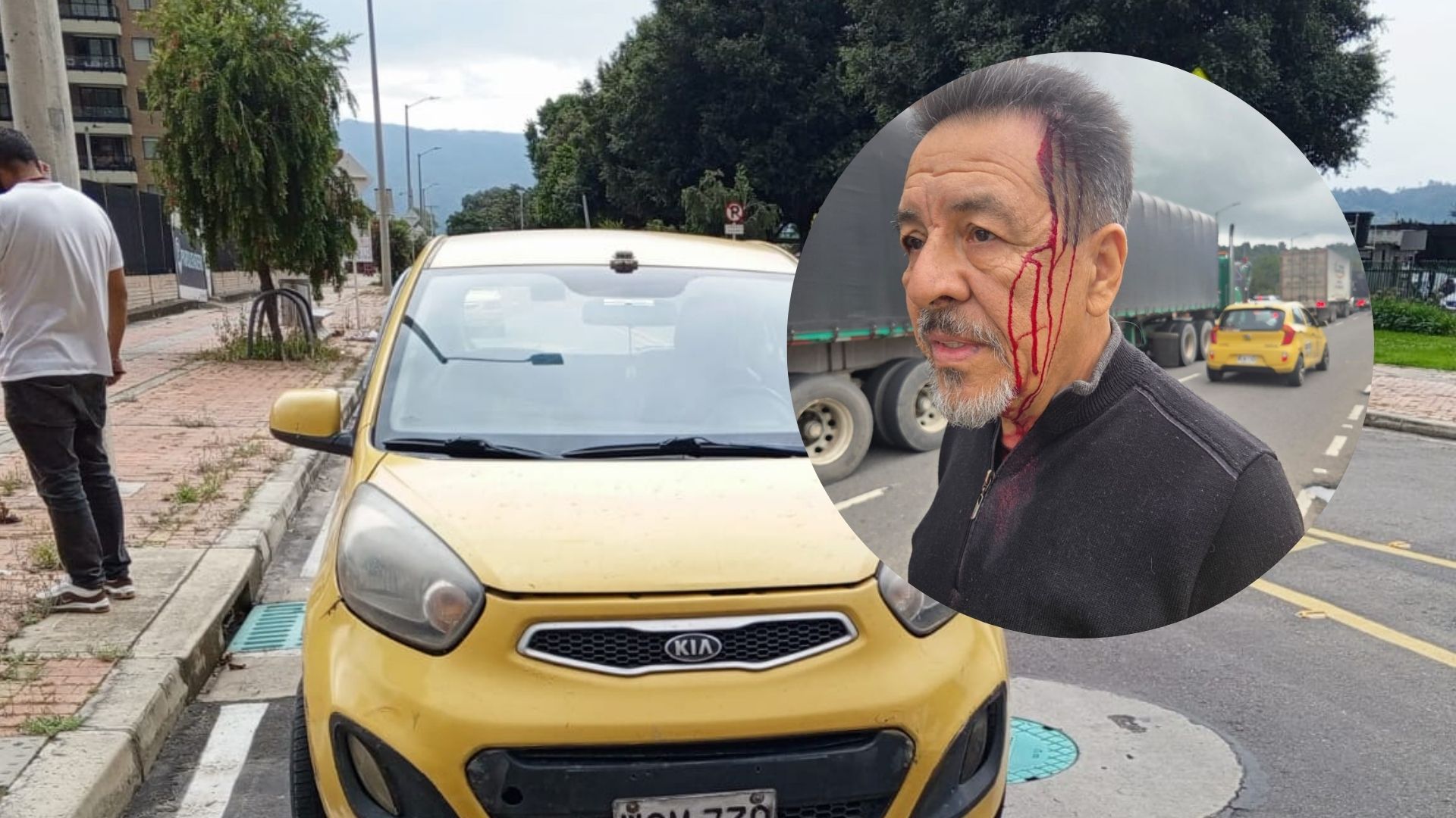 El taxista tenía en su poder un bolillo con el que agredió al hombre.