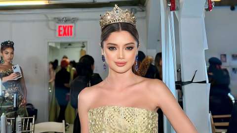 Ella es la modelo con labio leporino que desfiló en NYFW. “Me dijeron deforme”