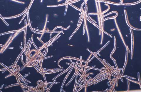 Más ágiles que cualquier atleta: los microbios más veloces que ha encontrado la ciencia