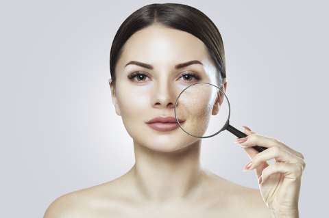 ¿Cómo eliminar las manchas del acné en el rostro?