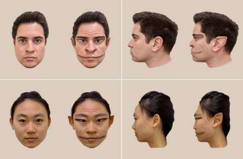 Así verían las caras las personas con esta extraña condición de salud