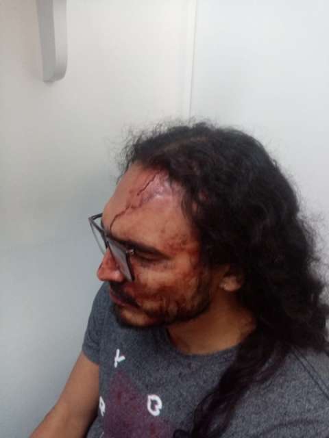 “La sangre no me dejaba abrir el ojo”:relato de un nuevo abuso policial en Bogotá