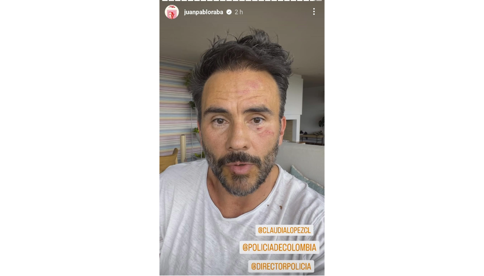 Juan Pablo Raba fue víctima de robo y golpiza frente a sus hijos en Bogotá