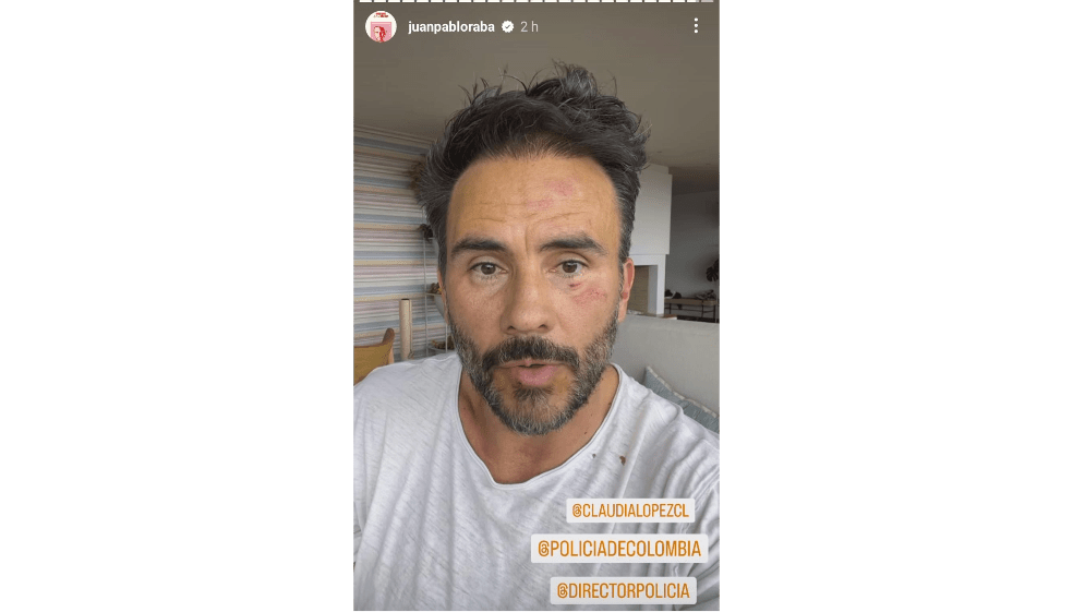 Juan Pablo Raba fue víctima de robo y golpiza frente a sus hijos en Bogotá