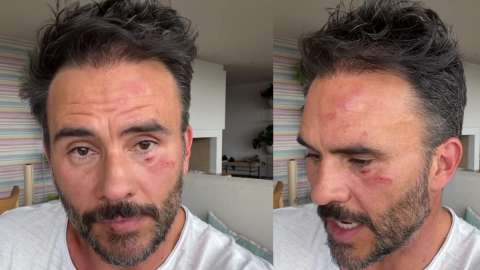 Juan Pablo Raba fue víctima de robo y golpiza frente a sus hijos en Bogotá