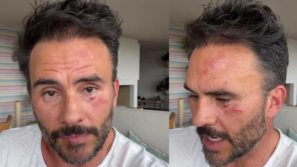 Juan Pablo Raba fue víctima de robo y golpiza frente a sus hijos en Bogotá