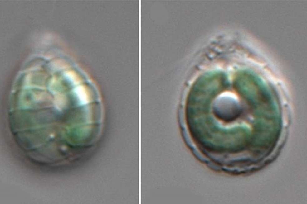 Este microbio acuático es conocido como Paulinella micropora.