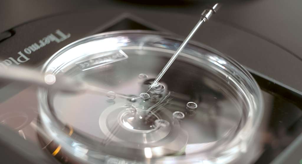 La congelación de óvulos es un tratamiento médico, que consiste en preservar los óvulos de una mujer