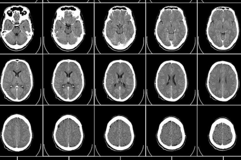 Ondas cerebrales se sincronizan cuando personas hablan lenguas extranjeras
