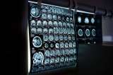 La adicción a internet podría estar alterando el cerebro de los adolescentes