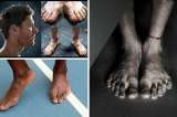 Los deportistas con los pies más feos