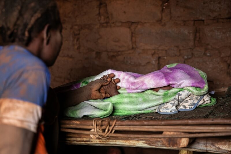 Solo el año pasado se murieron 6.600 niños de sarampión en Républica Centroafricana. / James Oatway / MSF