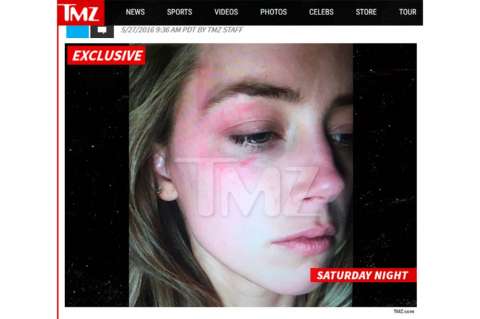 Amber Heard acusa a Johnny Depp de golpearla con un "iPhone en el rostro"