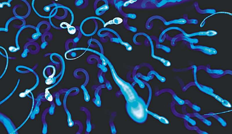 La pregunta que guió a los investigadores tiene que ver con las complejas relaciones entre el sistema inmune y la producción de nuevos espermatozoides en el cuerpo del varón. / iStock