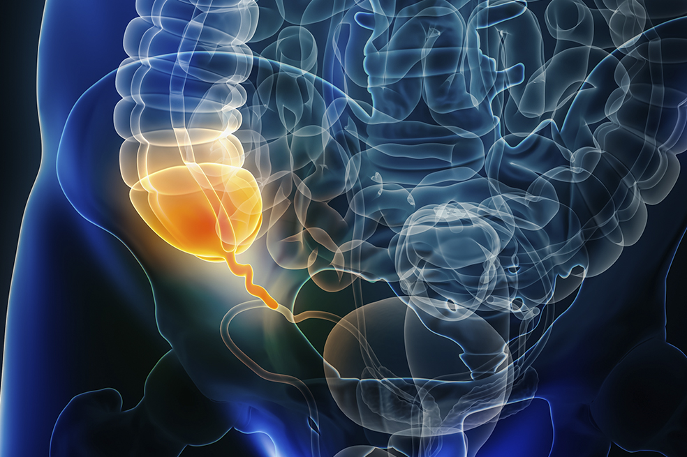 Apendicitis