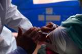 Vacuna contra el herpes zóster no será cubierta por el sistema público: ¿por qué?