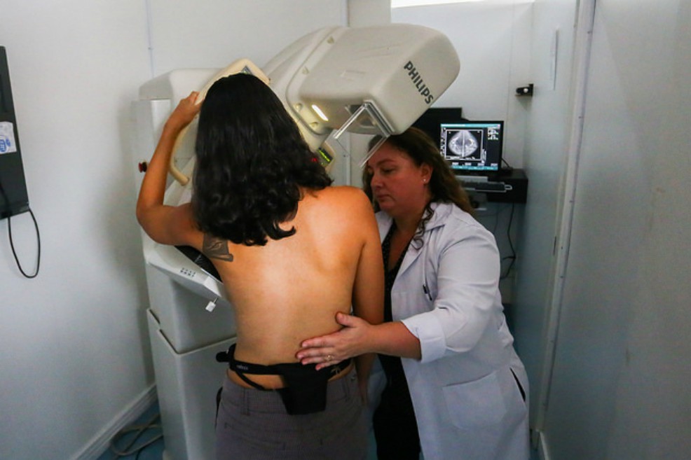 Las nuevas variantes de riesgo identificadas en el estudio doblan, casi, el número de las que ya se conocían sobre el cáncer de seno. / Flickr, Gobierno del Estado de Sao Paulo.