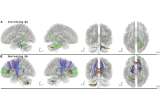 ¿Qué le pasa al cerebro luego de estar mucho tiempo en el espacio? La ciencia responde