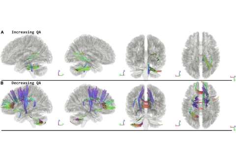 ¿Qué le pasa al cerebro luego de estar mucho tiempo en el espacio? La ciencia responde