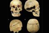 Así se ve el cráneo de un joven que murió por varios golpes de espada hace 700 años
