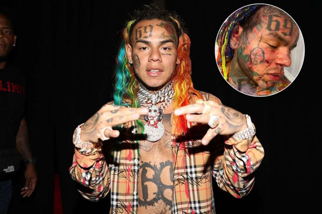 Rapero 6ix9ine en urgencias tras recibir fuerte golpiza en un gimnasio de Miami