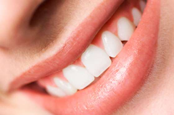 Tips para que tu sonrisa sea la más linda de todas