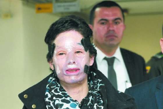 La ley Natalia Ponce de León endureció las penas para los victimarios de agresiones con ácido. /Cristian Garavito